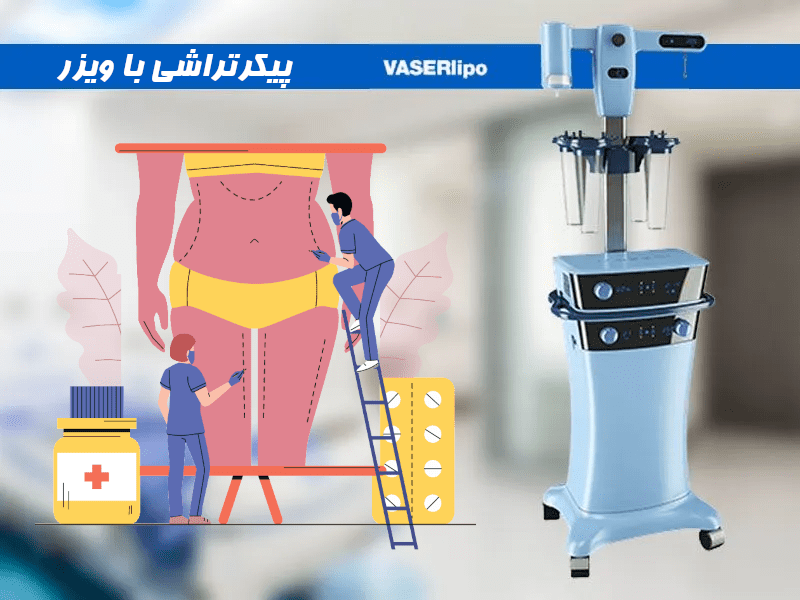 پیکرتراشی با ویزر