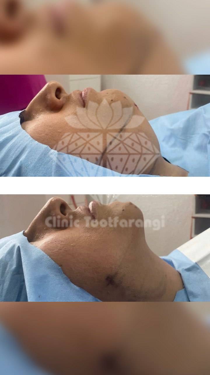 -5875219492756375366_121
