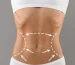 slimming-body-shaping-drmirhaji-01-qcn0mw8uwws4h3aw72q547ps5ktgyo71llrq25bna8.jpg