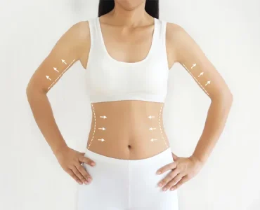 what-is-body-contouring